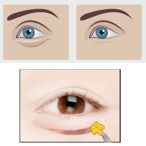 huong-dan-chi-tiet-cach-cham-soc-sau-ha-bau-mat-giup-phuc-hoi-nhanh-va-mat-dep-tu-nhien-an-toan