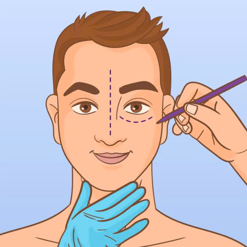 cay-mo-mi-mat-cuoi-cho-nam-giai-phap-giup-doi-mat-tre-trung-tu-tin-cuon-hut