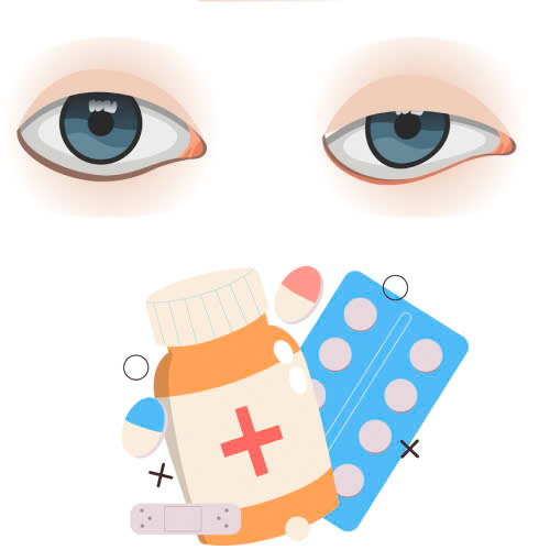 cham-soc-sau-nang-co-mi-bi-quyet-giup-doi-mat-hoi-phuc-nhanh-va-dep-tu-nhien-lau-dai