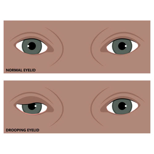 cham-soc-sau-nang-co-mi-bi-quyet-giup-doi-mat-hoi-phuc-nhanh-va-dep-tu-nhien-lau-dai