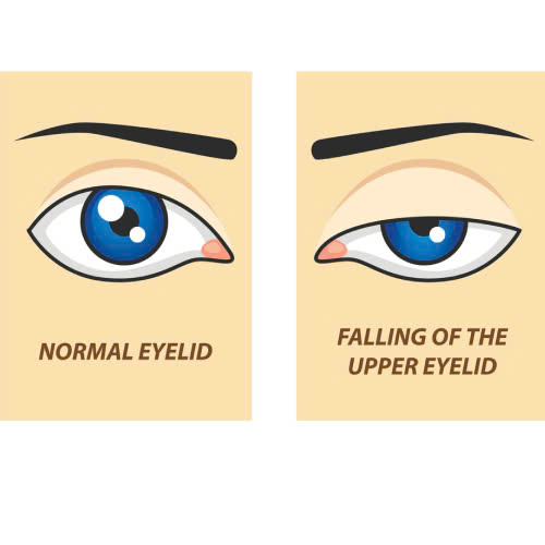bo-tui-5-tieu-chi-lua-chon-dia-chi-nang-co-mi-uy-tin-an-toan-va-hieu-qua-lau-dai