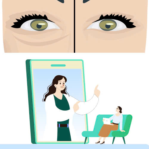 ha-bau-mat-bao-lau-thi-lanh-va-cach-cham-soc-de-hoi-phuc-nhanh-hieu-qua