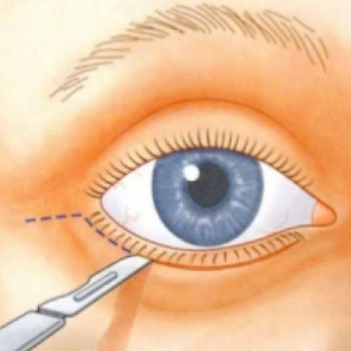 ha-bau-mat-bi-hong-phai-lam-sao-nguyen-nhan-dau-hieu-va-cach-xu-ly-an-toan