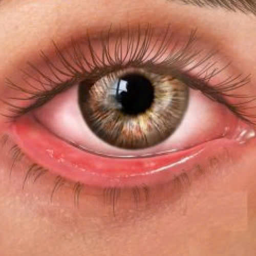 ha-bau-mat-bi-hong-phai-lam-sao-nguyen-nhan-dau-hieu-va-cach-xu-ly-an-toan