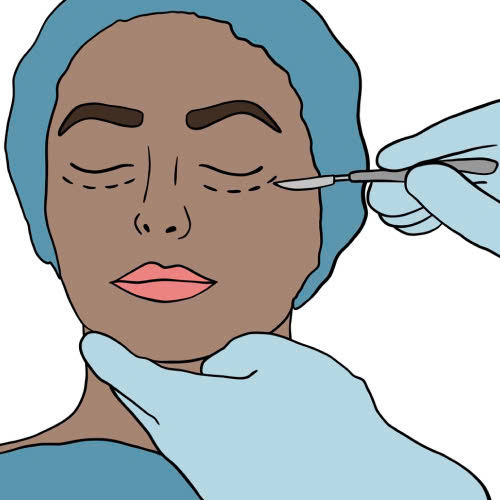 ha-bau-mat-bi-hong-phai-lam-sao-nguyen-nhan-dau-hieu-va-cach-xu-ly-an-toan