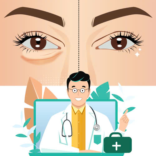 ha-bau-mat-bi-sung-bao-lau-giai-dap-chi-tiet-giup-ban-yen-tam-lam-dep