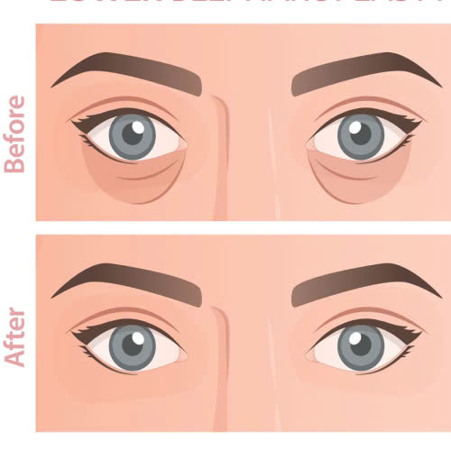 ha-bau-mat-cho-nam-gioi-giai-phap-giup-guong-mat-tre-trung-cuon-hut-va-tu-tin-hon