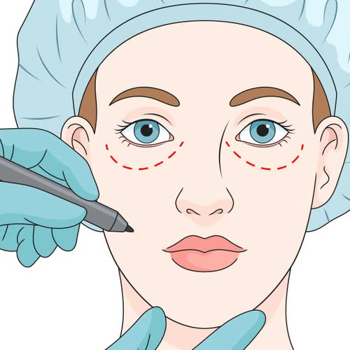 ha-bau-mat-co-dau-khong-he-lo-cach-giam-dau-va-phuc-hoi-nhanh-sau-ha-bau-mat