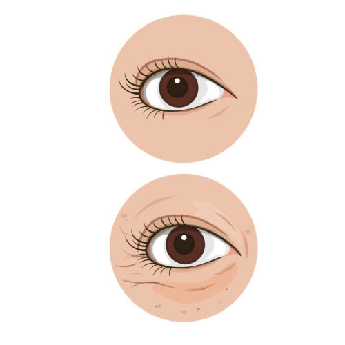 ha-bau-mat-co-dau-khong-he-lo-cach-giam-dau-va-phuc-hoi-nhanh-sau-ha-bau-mat