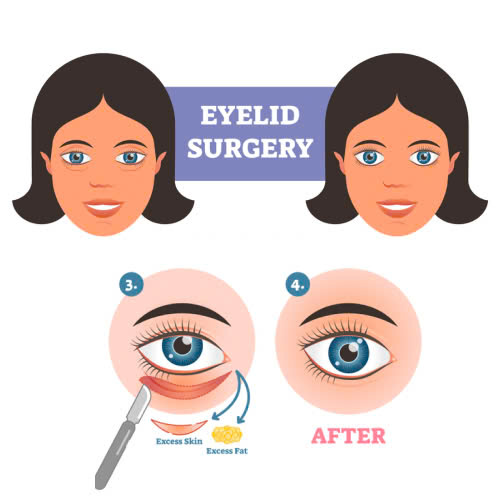 ha-bau-mat-co-thay-doi-tuong-so-khong-vi-sao-nhieu-nguoi-nghi-ha-bau-mat-anh-huong-den-van-menh