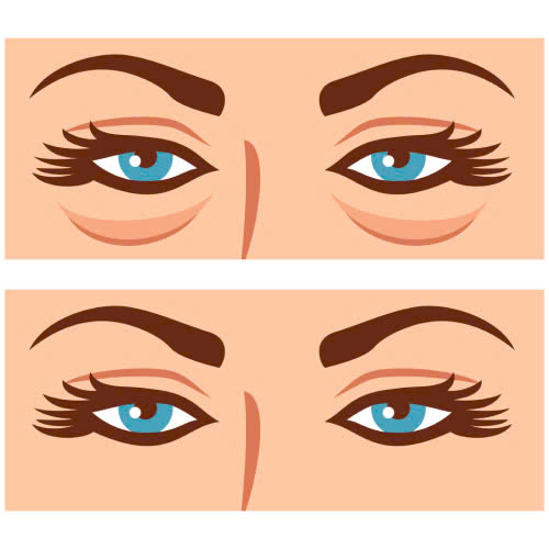 ha-bau-mat-gia-bao-nhieu-co-nen-dau-tu-de-tre-hoa-cua-so-tam-hon