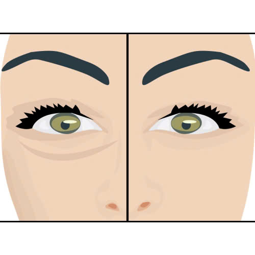 ha-bau-mat-gia-bao-nhieu-co-nen-dau-tu-de-tre-hoa-cua-so-tam-hon