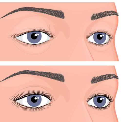 ha-bau-mat-giu-duoc-bao-lau-mach-ban-cac-cach-giu-doi-mat-tre-trung-hieu-qua-lau-dai