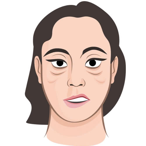 ha-bau-mat-giu-duoc-bao-lau-mach-ban-cac-cach-giu-doi-mat-tre-trung-hieu-qua-lau-dai