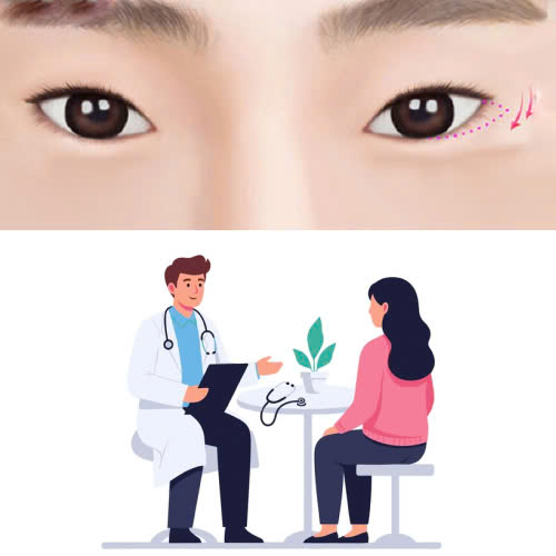 ha-bau-mat-giup-mat-to-hon-khong-tim-hieu-hieu-qua-that-su-sau-khi-thuc-hien-phuong-phap-lam-dep-nay