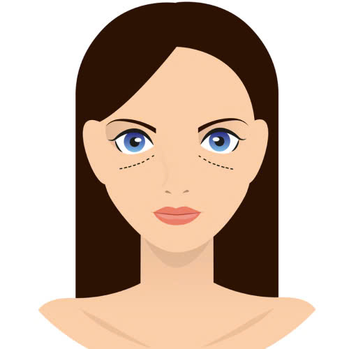 ha-bau-mat-giup-mat-to-hon-khong-tim-hieu-hieu-qua-that-su-sau-khi-thuc-hien-phuong-phap-lam-dep-nay