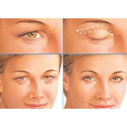 ha-bau-mat-ket-hop-cat-mi-la-gi-giai-phap-2-trong-1-giup-mat-tre-trung-dep-tu-nhien