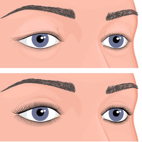 ha-bau-mat-ket-hop-cat-mi-la-gi-giai-phap-2-trong-1-giup-mat-tre-trung-dep-tu-nhien