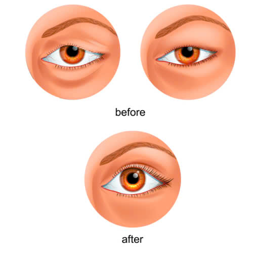 ha-bau-mat-ket-hop-cat-mi-la-gi-giai-phap-2-trong-1-giup-mat-tre-trung-dep-tu-nhien