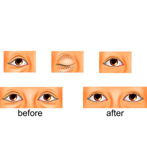 giai-dap-chi-tiet-ha-bau-mat-tu-nhien-dep-khong-va-co-an-toan-khong