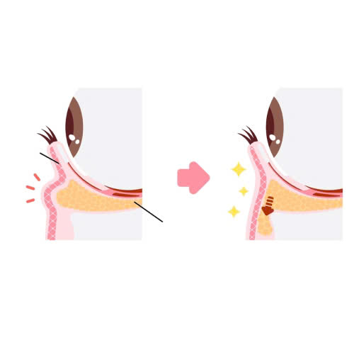 giai-dap-chi-tiet-ha-bau-mat-tu-nhien-dep-khong-va-co-an-toan-khong