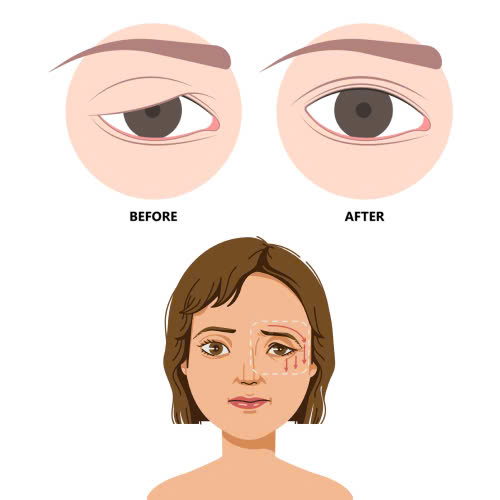 nang-co-mi-bi-hong-phai-lam-sao-nhung-thong-tin-bo-ich-ban-khong-nen-bo-qua