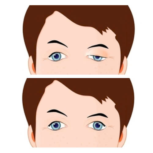 nang-co-mi-cho-nam-gioi-la-gi-quy-trinh-hieu-qua-va-nhung-luu-y-quan-trong