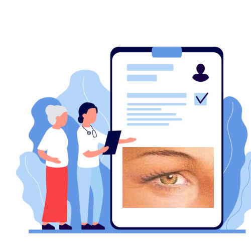 vi-sao-nen-lua-chon-nang-co-mi-mat-cho-nguoi-lon-tuoi-de-khac-phuc-da-chung-sup-mi