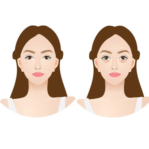 phau-thuat-ha-bau-mat-bao-lau-thi-on-dinh-cung-tim-hieu-bi-quyet-giup-mat-mau-on-dinh-va-rut-ngan-thoi-gian-hoi-phuc