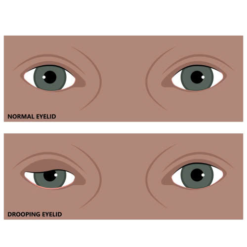 review-nang-co-mi-uu-nhuoc-diem-va-kinh-nghiem-lam-dep-ban-nen-biet