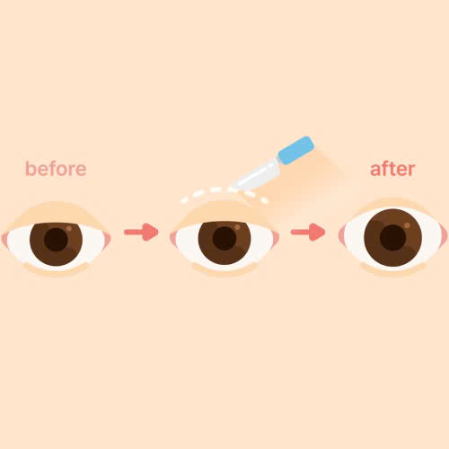 review-nang-co-mi-uu-nhuoc-diem-va-kinh-nghiem-lam-dep-ban-nen-biet