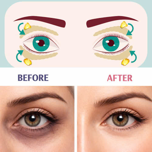 cach-cham-soc-sau-cay-mo-mat-giup-doi-mat-nhanh-hoi-phuc-an-toan-dep-tu-nhien-nhu-mong-muon