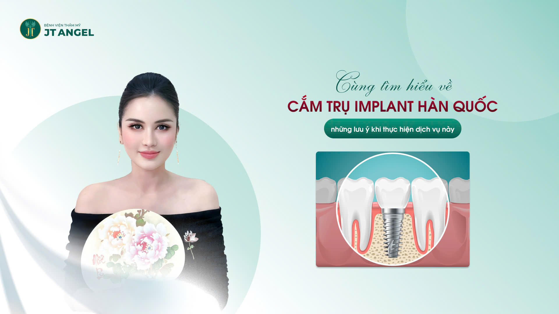 cung-tim-hieu-ve-cam-tru-implant-han-quoc-va-nhung-luu-y-khi-thuc-hien-dich-vu-nay