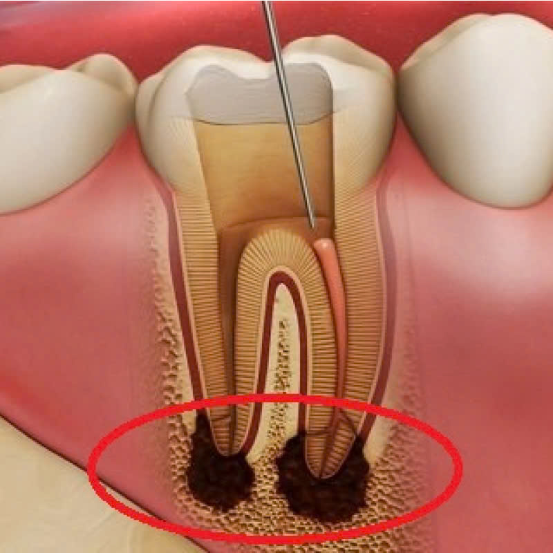 cat-chop-co-dau-khong-phuong-phap-nay-se-ap-dung-vao-nhung-truong-hop-nao