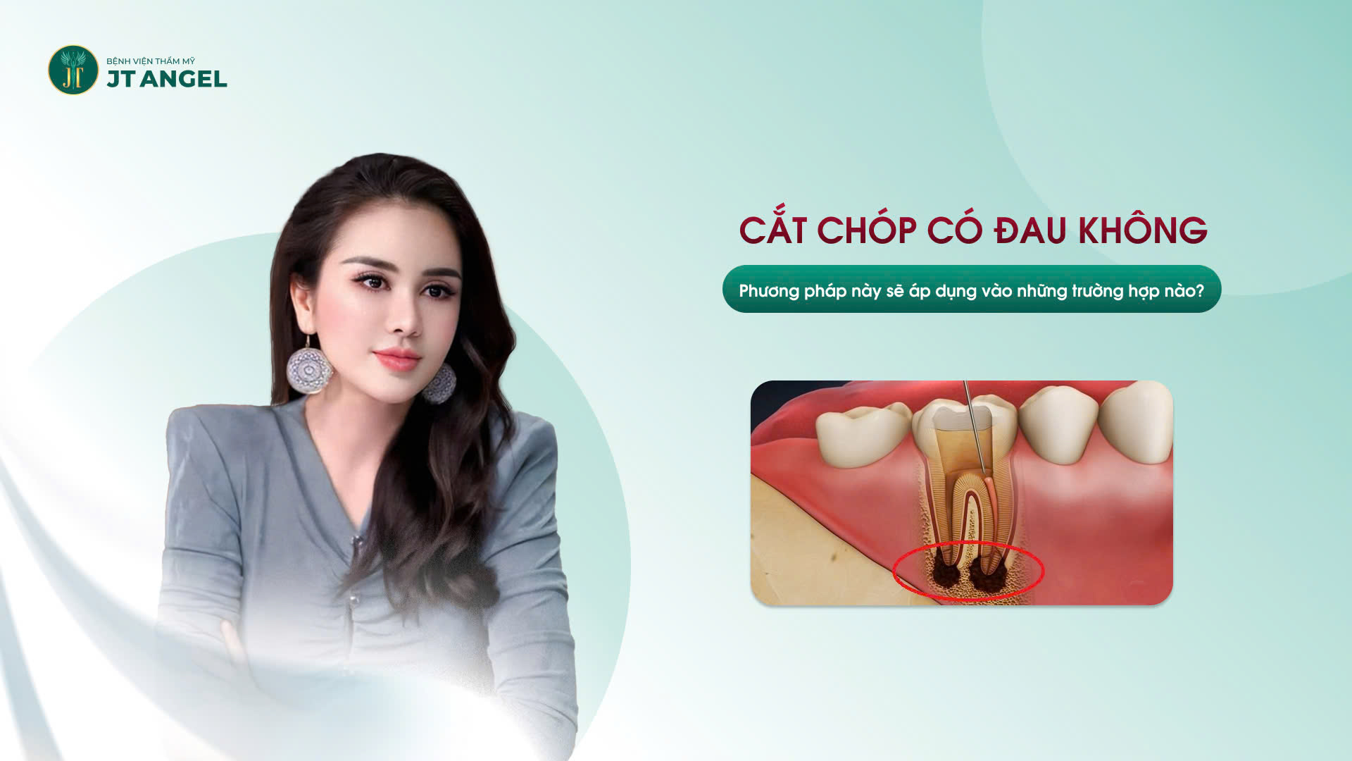 cat-chop-co-dau-khong-phuong-phap-nay-se-ap-dung-vao-nhung-truong-hop-nao