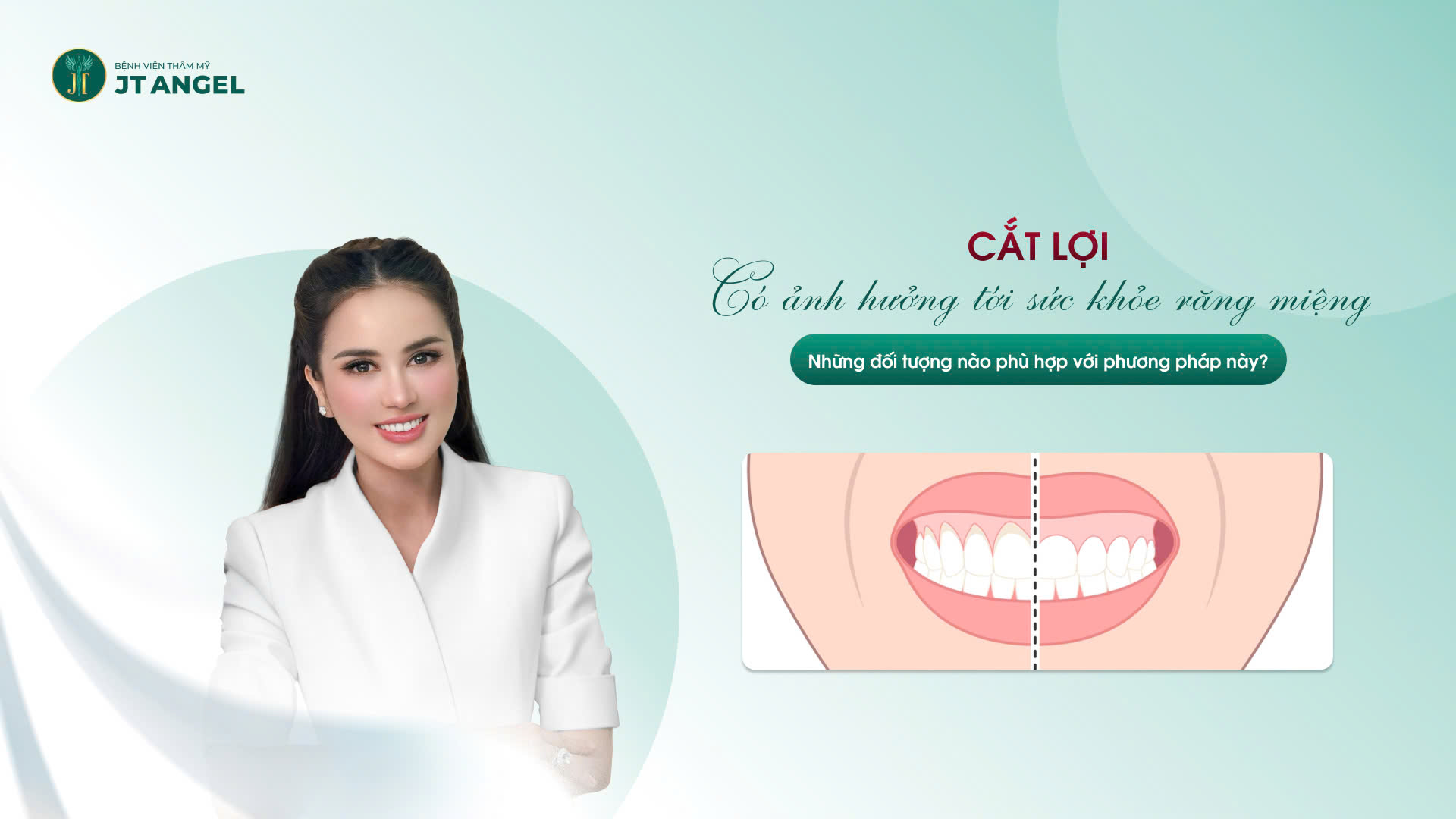 cat-loi-co-anh-huong-toi-suc-khoe-rang-mieng-khong-nhung-doi-tuong-nao-phu-hop-voi-phuong-phap-nay