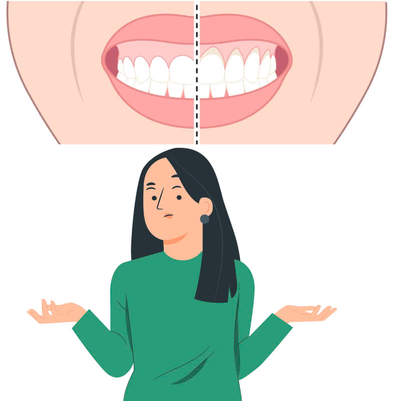 cat-ngan-ho-loi-noi-loi-tam-biet-voi-nu-cuoi-thieu-tham-my-tu-tin-voi-nu-cuoi-rang-ro