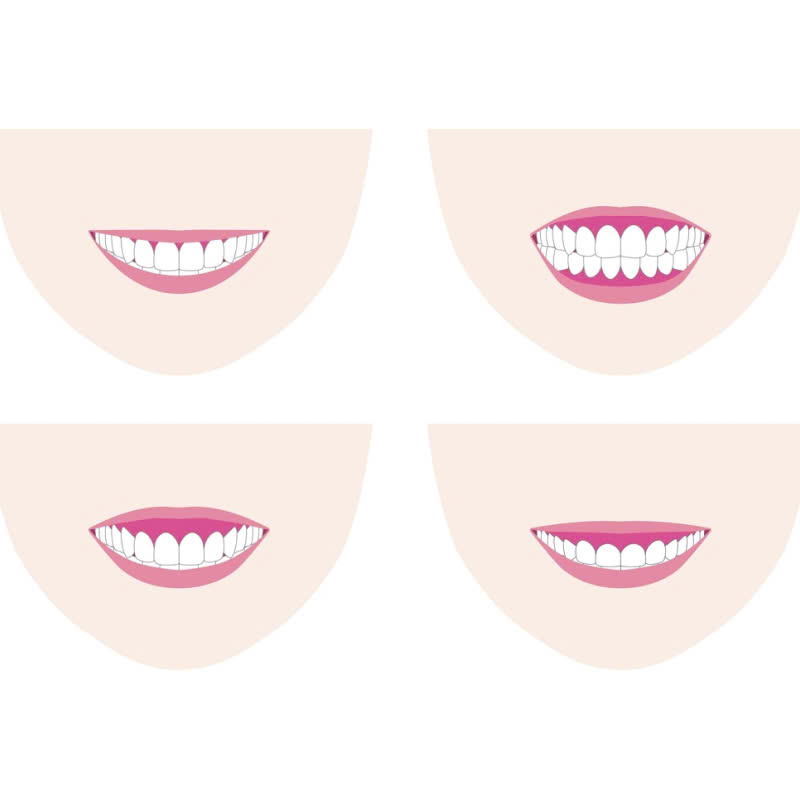 cat-ngan-ho-loi-noi-loi-tam-biet-voi-nu-cuoi-thieu-tham-my-tu-tin-voi-nu-cuoi-rang-ro