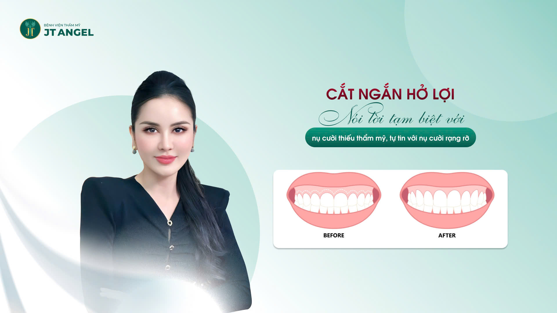 cat-ngan-ho-loi-noi-loi-tam-biet-voi-nu-cuoi-thieu-tham-my-tu-tin-voi-nu-cuoi-rang-ro