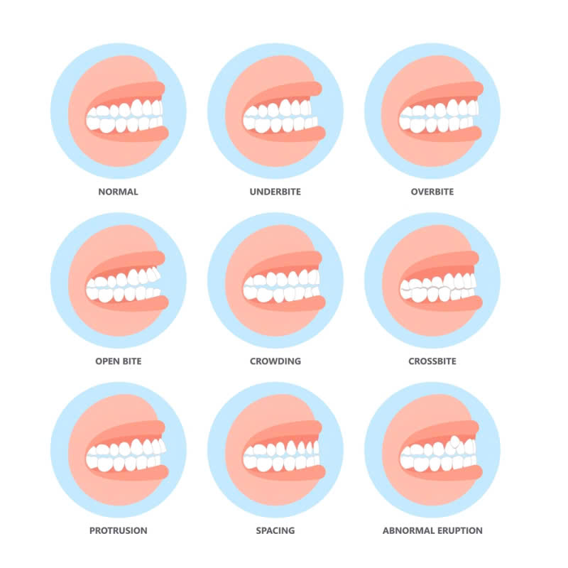 phuong-phap-cat-nuou-chinh-xuong-co-lam-rang-yeu-di-khong