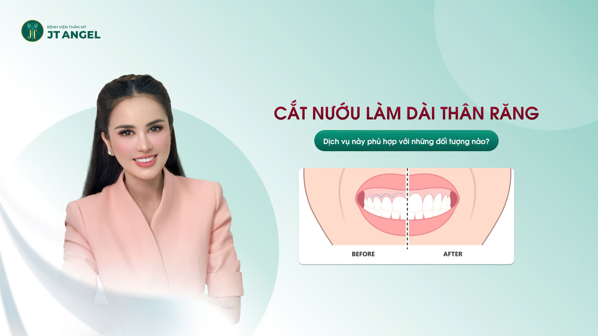 cat-nuou-lam-dai-than-rang-la-gi-dich-vu-nay-phu-hop-voi-nhung-doi-tuong-nao