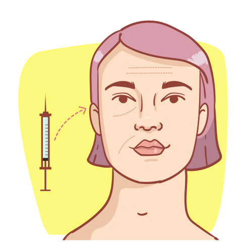 cay-mo-mat-bao-lau-thi-dep-tu-nhien-cung-tim-hieu-lo-trinh-hoi-phuc-tung-giai-doan-cua-phuong-phap-lam-dep-nay