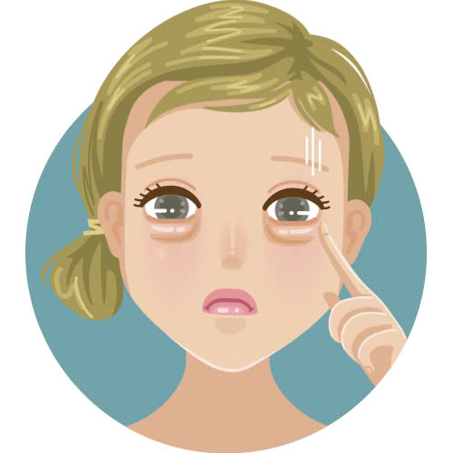 cay-mo-mat-bi-von-cuc-co-nguy-hiem-khong-cung-tim-hieu-nguyen-nhan-dau-hieu-va-cach-khac-phuc-phong-ngua-hieu-qua