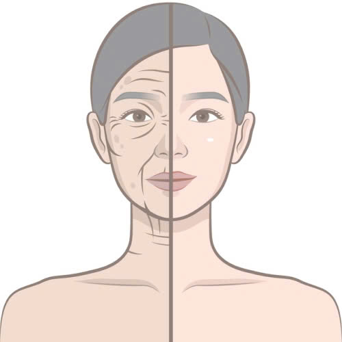 cay-mo-mat-cho-nguoi-lon-tuoi-giai-phap-tre-hoa-tu-nhien-an-toan-giup-khac-phuc-hoc-mat-lom-va-quang-tham