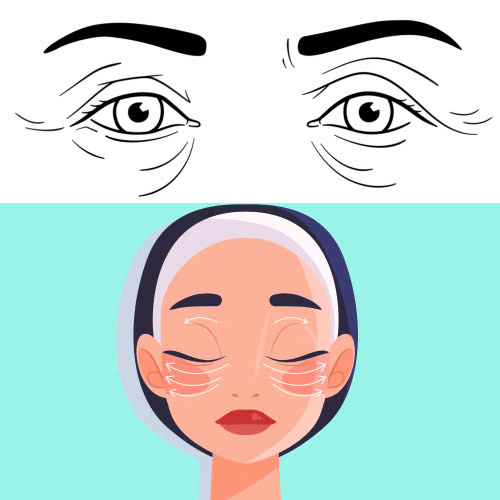 cay-mo-mat-cho-nguoi-lon-tuoi-giai-phap-tre-hoa-tu-nhien-an-toan-giup-khac-phuc-hoc-mat-lom-va-quang-tham