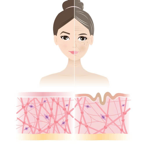 cay-mo-mat-cho-nguoi-lon-tuoi-giai-phap-tre-hoa-tu-nhien-an-toan-giup-khac-phuc-hoc-mat-lom-va-quang-tham