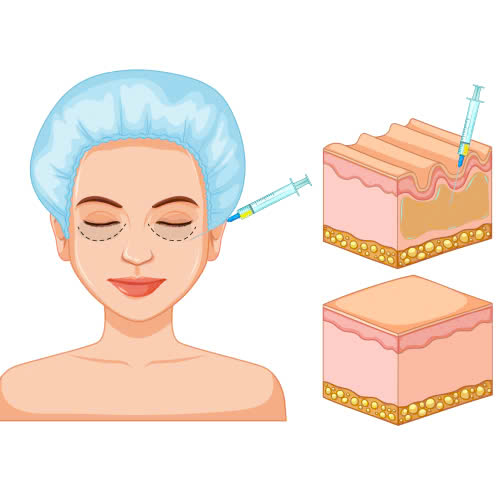 cay-mo-mat-co-dau-khong-cach-cham-soc-sau-khi-cay-mo-mat-de-giam-dau-va-hoi-phuc-nhanh