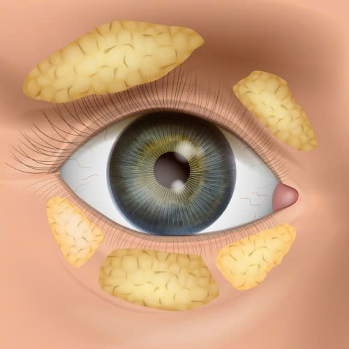 cay-mo-mat-co-de-lai-seo-khong-giai-dap-chi-tiet-giup-ban-hieu-ro-yen-tam-truoc-khi-thuc-hien