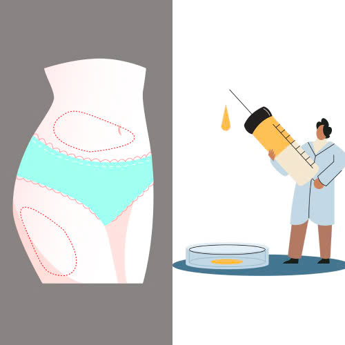 cay-mo-mat-co-de-lai-seo-khong-giai-dap-chi-tiet-giup-ban-hieu-ro-yen-tam-truoc-khi-thuc-hien