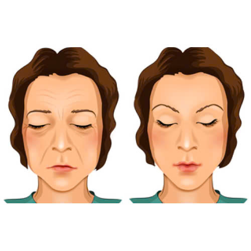 cay-mo-mat-co-nguy-hiem-khong-vi-sao-nen-chon-cay-mo-tu-than-thay-vi-chon-cac-phuong-phap-khac